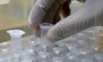 Korona virüs için antikor testleri satışına başlanıyor