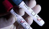 Her yıl 3-4 bin kişiye HIV bulaşıyor