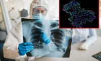 Virüsün hücrelere nasıl saldırdığını anlamak için yapay akciğer ürettiler! 