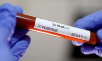 Bulgaristan'da koronavirüs nedeniyle ilk ölüm