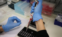 Korona virüs test sonuçları eNabız'dan öğrenilebilecek