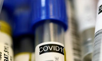 FDA, 2 dakikada sonuç verecek koronavirüs testine onay verdi