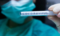 Korona virüsün üç yeni belirtisi ortaya çıktı! 