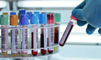 Roche'un antikor testine ABD'den 'acil durum' onayı