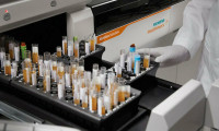 Korona virüse karşı bağışıklığı ölçen test kiti geliştirildi 