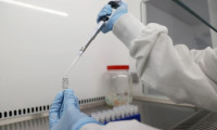 Bir şirket daha Kovid-19 aşısının insan testlerine başlıyor