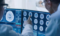 Bilim insanlarından yeni uyarı: Korona virüs bağlantılı beyin hasarı