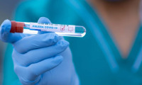 Sanofi ile 300 milyon doz kovid-19 aşısı anlaşması
