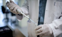 Rusya virüs aşısını onaylayacağı tarihi açıkladı