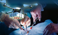 Dünyada bir ilk! Hastaya nakledilecek akciğer drone ile taşındı