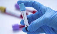 DSÖ'den, ilk kez bir Kovid-19 antikor test kitine uluslararası lisans 