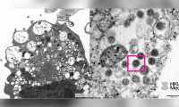 Omikron varyantının elektron mikroskobu görüntüsü yayınlandı