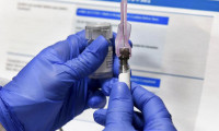 DSÖ'den aşı konusunda adaletsizlik uyarısı