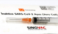 Sinovac araştırmasını yürüten bilim insanı korona virüsünden öldü!
