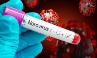 Uzmanlardan 'norovirüs' uyarısı: Vakalar 3 kat arttı!