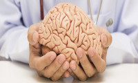 Yeni araştırma: Kovid-19 hafif seyretse bile beyni küçültüyor