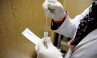 SARS-CoV-2 virüsünü ‘avlamak’ için ilaç geliştirildi