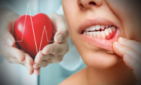 Dişlerdeki bu semptom kalp hastalıklarının sinyali!