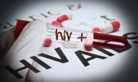 Yeni varyant tehlikesi: AIDS vakaları ikiye katlanacak!