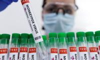 ABD, eyaletlere maymun çiçeği aşısı gönderecek