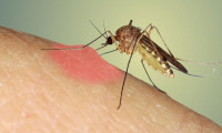 Sivrisinekler bazı insanları niçin daha çok ısırıyor?