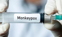 ABD, maymun çiçeği virüsü için ek aşı sipariş etti