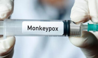 ABD 2.5 milyon doz daha maymun çiçeği aşısı siparişi verdi