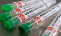 Avustralya 450 bin doz maymun çiçeği virüsü aşısı aldı