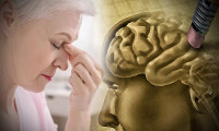 Alzheimer seneler öncesinden işaret veriyor: İşte erken dönem belirtileri!