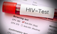 Bilim Kurulu Üyesi uyardı: Türkiye’de HIV pandemisi var!