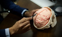 Bilim dünyasında ilk: Beyin bedenden ayrı canlı tutuldu!