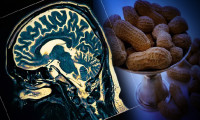 Alzheimer hastalığının şifası: Hafıza gücünü arttıran besinler...