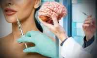 Yeni araştırma: Botoks beyni etkiliyor!
