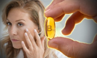 B12 vitamin eksikliğini gösteren ciltteki bu belirtiye dikkat!