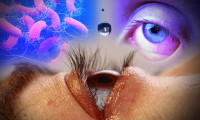 Yeni salgın paniği: Gözün içinde eriyen ölümcül bakteri!