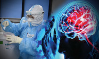 Çinli 'bilim insanları' yaratmış: Beyne saldıran öldürücü mutant Kovid!