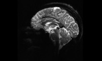 İnsan beyninin en net görüntüsü yayınlandı!