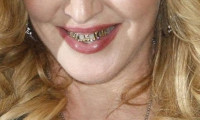 Altın diş modası hızla yayılıyor