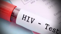 Türkiye'de HIV artış eğiliminde: Gizli pandemi gibi!