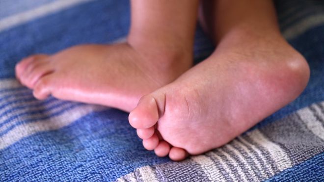 Çift rahimli kadın ilk doğumdan 26 gün sonra ikiz doğurdu