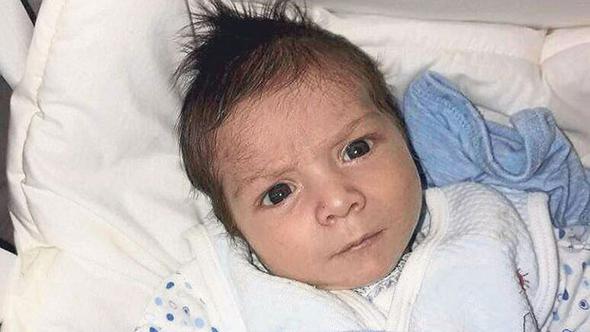 İspanya'da yanlış ilaç verilen bebeklerde 'kurt adam' belirtileri 