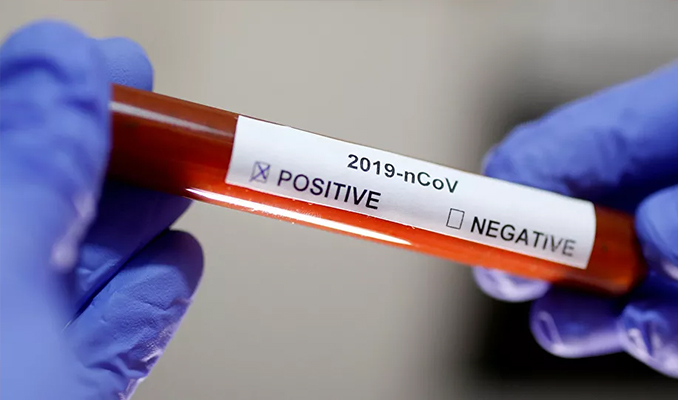 Bulgaristan'da koronavirüs nedeniyle ilk ölüm