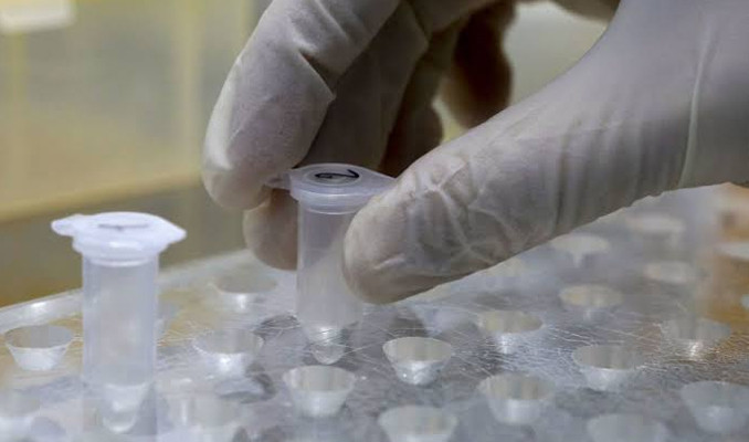 Korona virüs için antikor testleri satışına başlanıyor