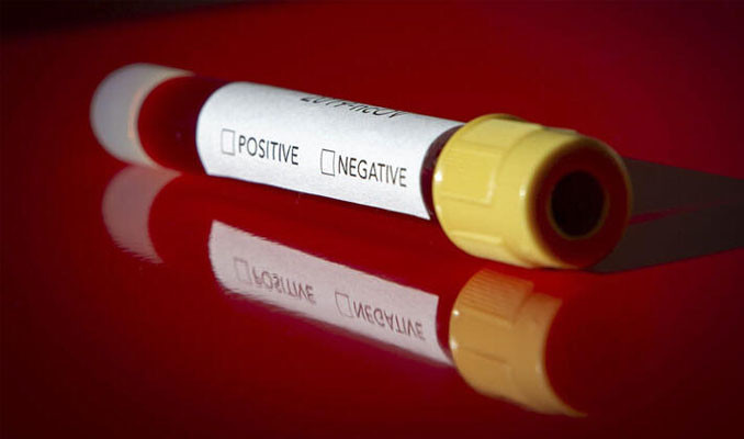 AB zirvesinde Bulgar yetkilinin virüs testleri pozitif çıktı