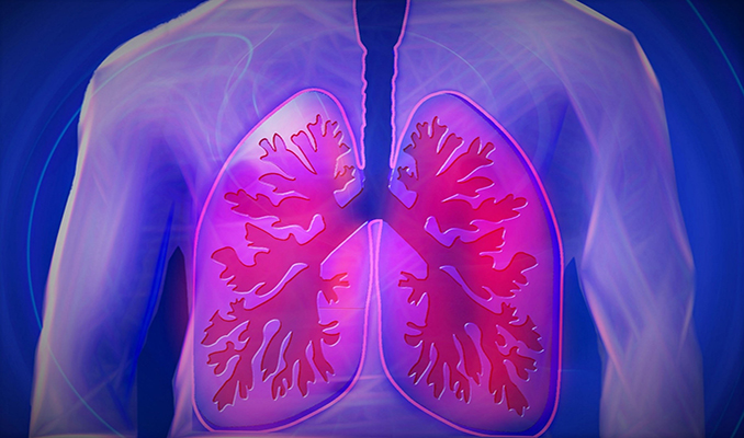 Kovid-19 akciğer hastalarında uzun süreli halsizliğe neden oluyor
