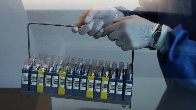 Belçika'da korona virüs test merkezlerinin kapasiteleri doldu