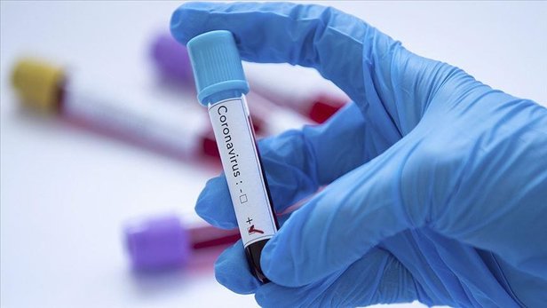 DSÖ'den, ilk kez bir Kovid-19 antikor test kitine uluslararası lisans 