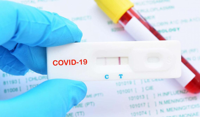  Omicron KOVID-19 testleri ile tespit edilebiliyor