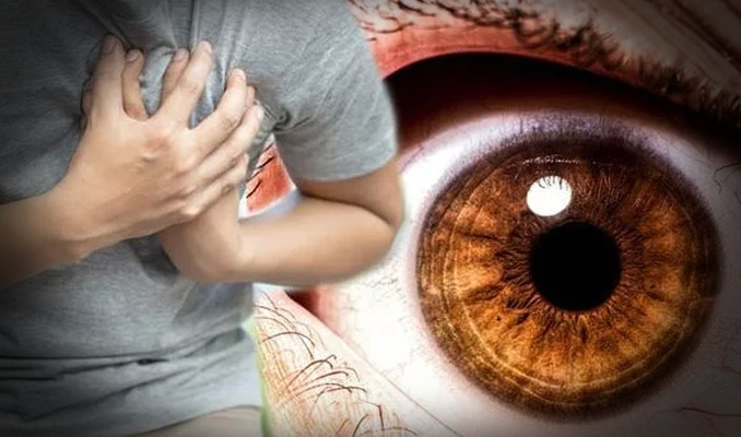 Uzmanlar inceledi: Gözden kalp hastalıkları tespiti!