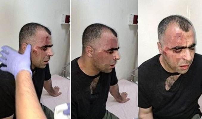 Bitlis'te gazeteciye darp: Belediye çalışanı ile bir polis açığa alındı